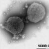 “子どもが感染”RSウイルス感染症患者 急増 コロナ対策影響か | 医療 | NHKニュース